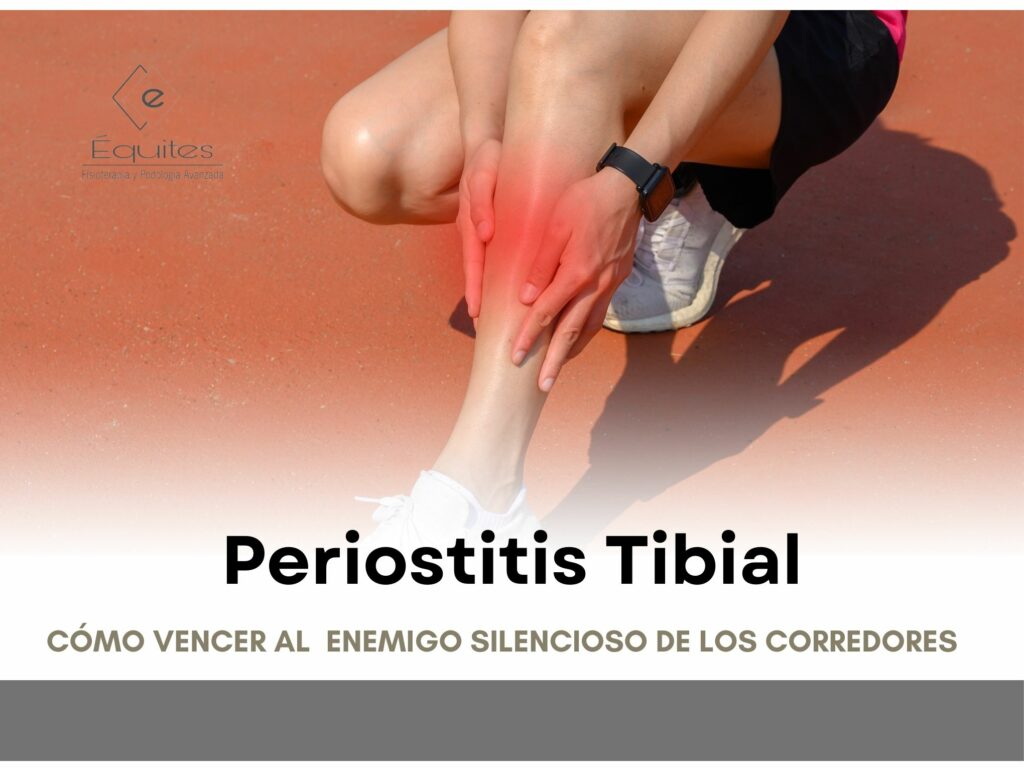 Periostitis Tibial